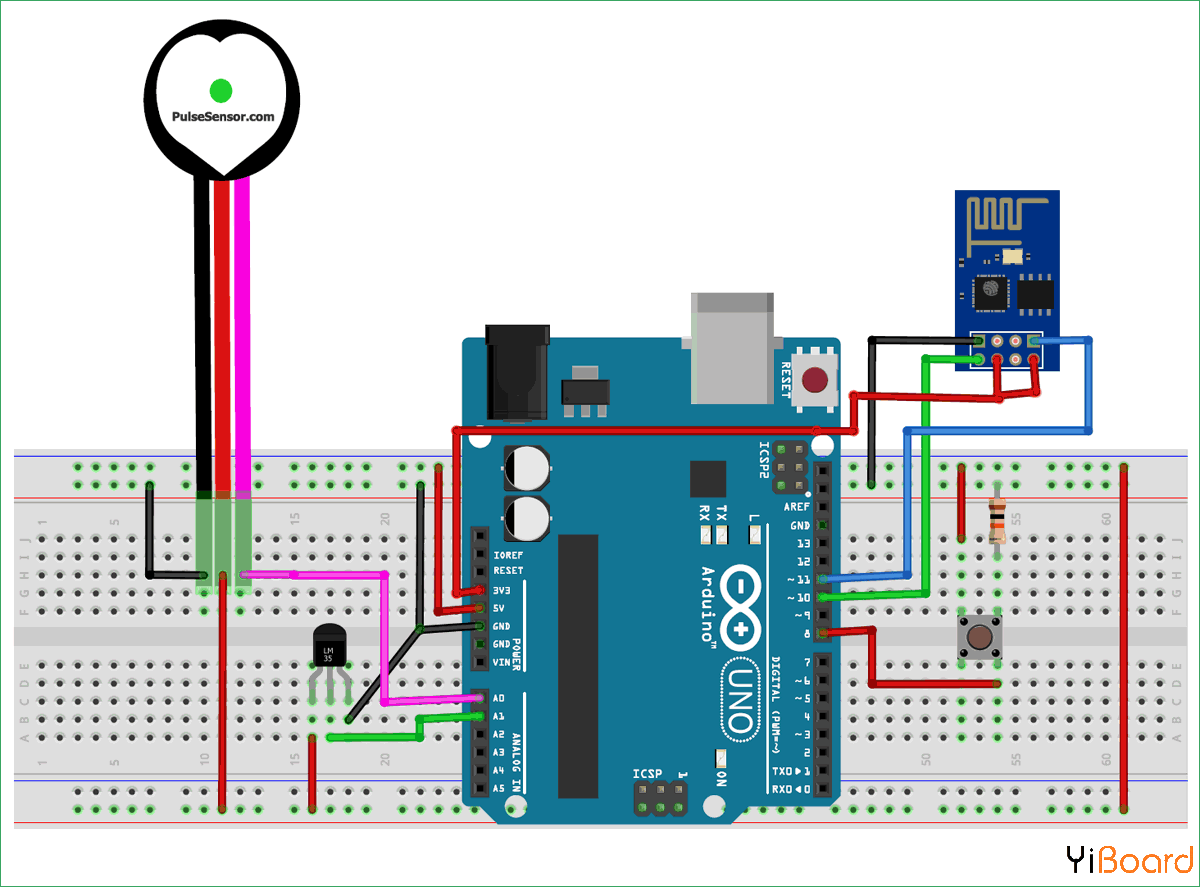 Circuit-Diagram-for-IoT-based-Patient-Monitoring-System-using-ESP8266-and-Arduino.png